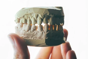 Просто чистити зуби замало: розпитали головну лікарку Autentica, що приховує ротова порожнина